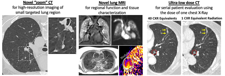 Novel zoom CT for high-resolution imaging of small targeted lung region; Novel lung MRI for regional function and tissue characterization; Ultra-low dose CT for serial patient evaluation using the dose of one chest X-Ray